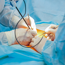 Minimally invasive surgery