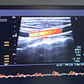 vascular ultrasound