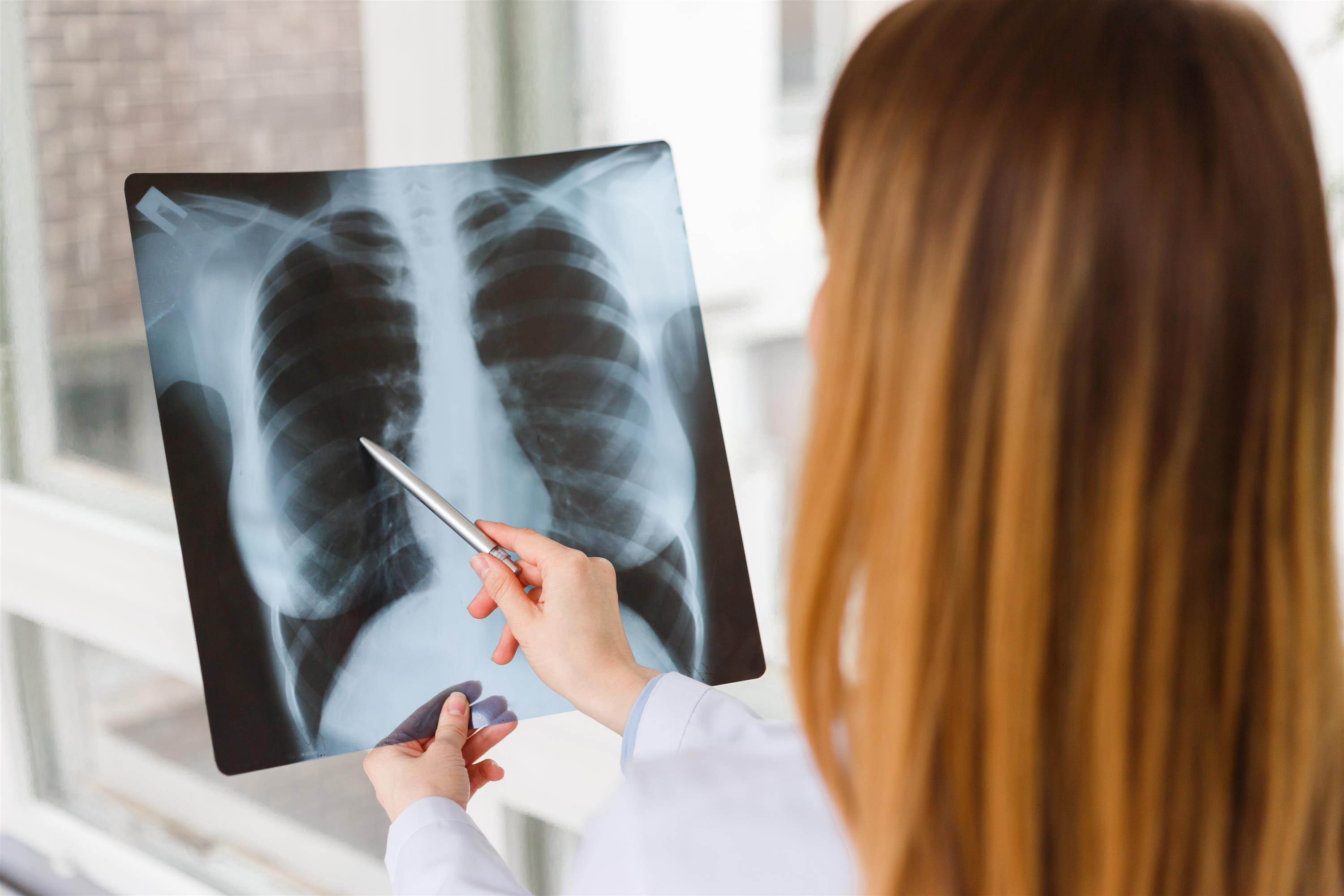 doctor looking at xrays